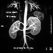 MR angiogram bubrega i aorte